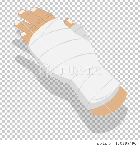 3D Isometric Flat Set of Hand Injury Treatment. Item 1 3D Isometric Flat Set of Hand Injury Treatment. Item 1 130895496