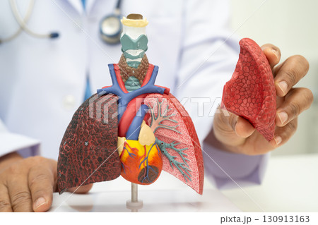 Pneumonia, lung cancer, Asian doctor holding human anatomy model for study diagnosis and treatment in hospital. 130913163