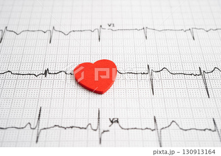 Electrocardiogram ECG heart wave, heart attack, cardiogram report. Electrocardiogram ECG heart wave, heart attack, cardiogram report. 130913164