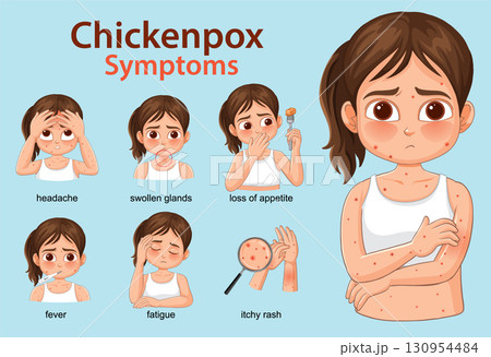 Chickenpox Symptoms Illustrated in Young Girl Vector Infographic 130954484