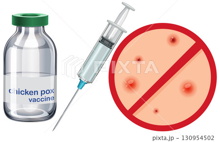 Chickenpox Vaccine Syringe and Immunization Concept Illustration 130954502