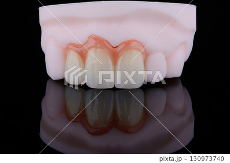 High-quality three dental crowns made of zirconium for fixation to the frontal teeth of upper jaw. 130973740