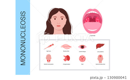 Mononucleosis symptoms poster 130980041