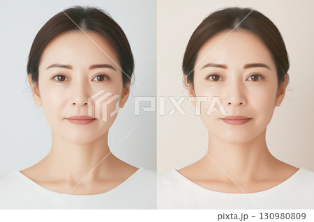 美容施術のビフォーアフター風 130980809