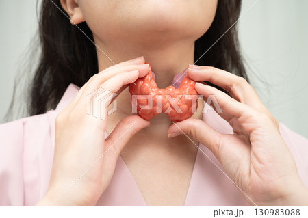 Hyperthyroidism, Overactive Thyroid, Thyroid Lymphoma, Asian woman with thyroid gland human anatomy model. 130983088