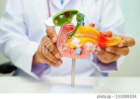 Pancreatitis, pancreatic cancer, Asian doctor with pancreas, gallbladder and bile duct human anatomy model at hospital. 131009104