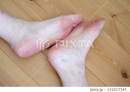 40代女性の足 40代女性の足 131017345