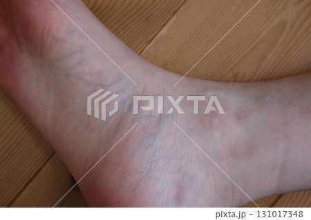 40代女性の足　 131017348