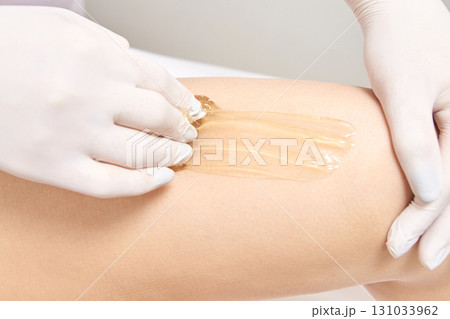 Caucasian adult applying sugaring paste on leg for hair removal with gloved Caucasian adult applying sugaring paste on leg for hair removal with gloved 131033962