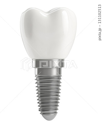 Dental Implant 131102513