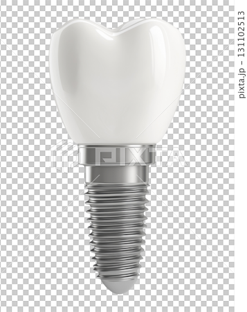 Dental Implant 131102513