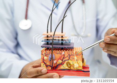 Hair transplant, Asian dermatologist doctor holding skin structure anatomy model for treatment in hospital. Hair transplant, Asian dermatologist doctor holding skin structure anatomy model for treatment in hospital. 131105554