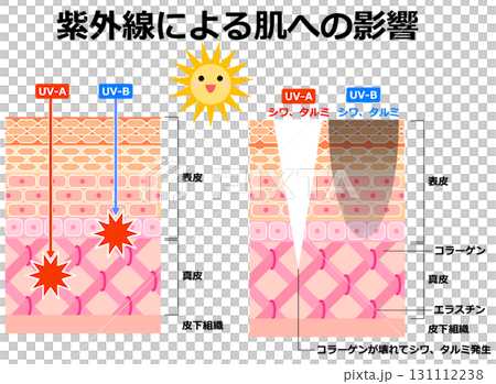 紫外線對皮膚的影響 紫外線對皮膚的影響 131112238