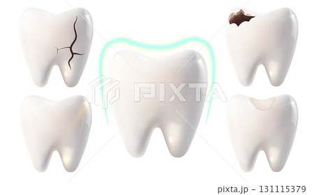 White teeth and teeth with various stages of decay and damage, a tooth with a filling and a tooth under protection on a white background 131115379