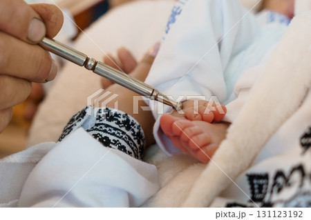 Newborn Heel Prick Test: Close-Up of Baby's Foot During Blood Sample Collection for Screening, White Clothing, Medical Device 131123192
