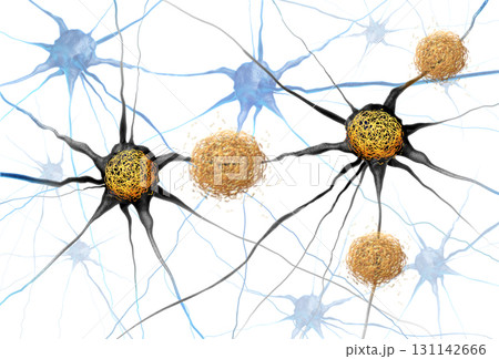 Amyloid Beta And Tau 131142666