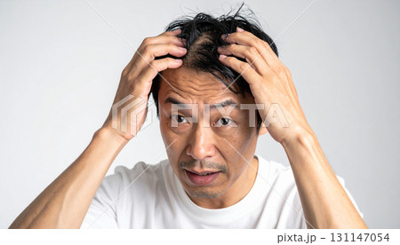 薄毛を気にする男性の頭（AI生成画像） 131147054