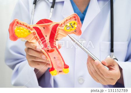 Uterus, doctor holding human anatomy model for study diagnosis and treatment in hospital. 131152789