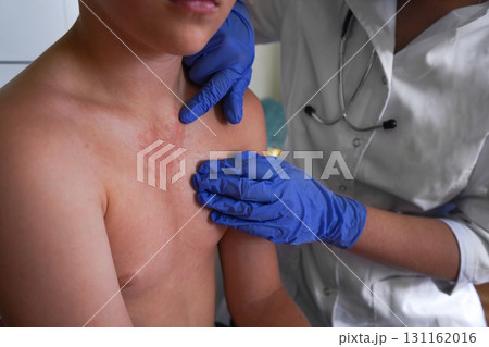 The doctor is assessing the boy for allergic skin reactions. 131162016