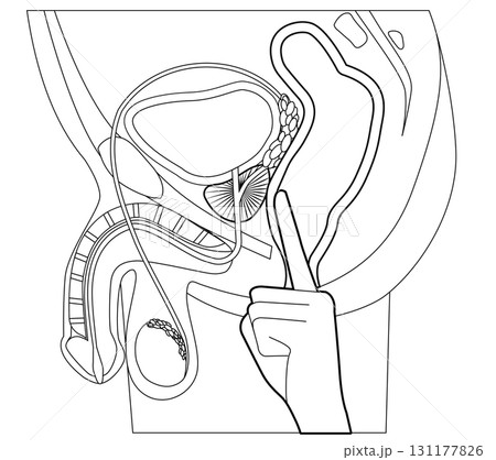 前立腺マッサージ位置 131177826