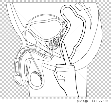 前立腺マッサージ位置 131177826