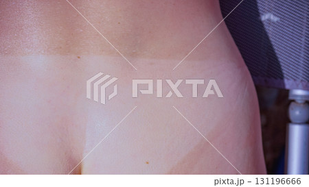 Woman body after taking off bikini with visible tan line from wearing panties 131196666