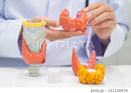 Hyperthyroidism, Overactive Thyroid, Thyroid Lymphoma, Asian doctor with thyroid gland human anatomy model in hospital. 131226974
