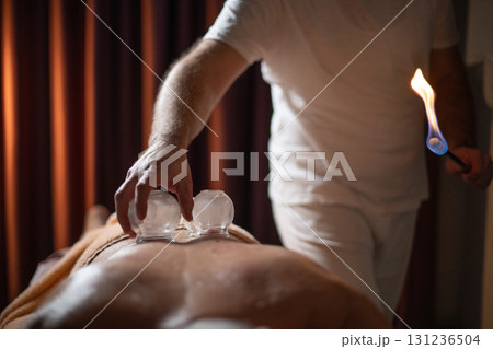Close up of a traditional fire cupping therapy session with glass cups placed on a patients back and therapist using fire to create suction, promoting relaxation and healing. Close up of a traditional fire cupping therapy session with glass cups placed on a patients back and therapist using fire to create suction, promoting relaxation and healing. 131236504
