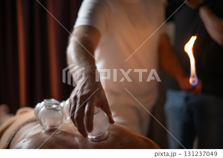 Close up of a traditional fire cupping therapy session with glass cups placed on a patients back and therapist using fire to create suction, promoting relaxation and healing. Close up of a traditional fire cupping therapy session with glass cups placed on a patients back and therapist using fire to create suction, promoting relaxation and healing. 131237049