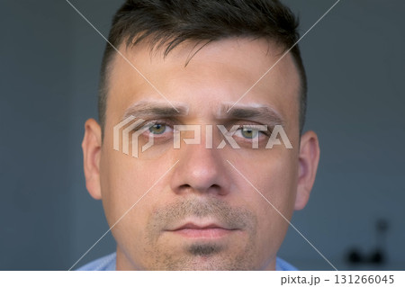 Man with white contour on eyebrows before painting in cosmetology clinic. Man with white contour on eyebrows before painting in cosmetology clinic. 131266045