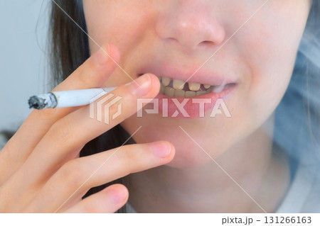 Young woman with yellow bad teeth smoking a cigarrete and smiling. Young woman with yellow bad teeth smoking a cigarrete and smiling. 131266163