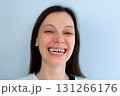 Portrait of young scary woman with yellow bad teeth laughing looking at camera. 131266176