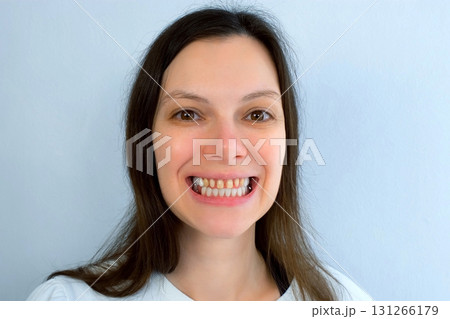 Portrait young smile woman with yellow bad teeth process dentistry prosthetics. Portrait young smile woman with yellow bad teeth process dentistry prosthetics. 131266179
