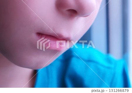 Child boy licks by tongue his cracked lips, mouth closeup. 131266879