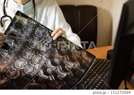 Medical professional examines chest X-ray in a well-lit hospital room Medical professional examines chest X-ray in a well-lit hospital room 131272094