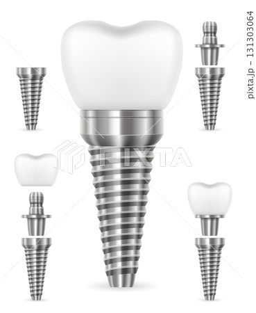 tooth metal human implant cartoon stock vector illustration tooth metal human implant cartoon stock vector illustration 131303064