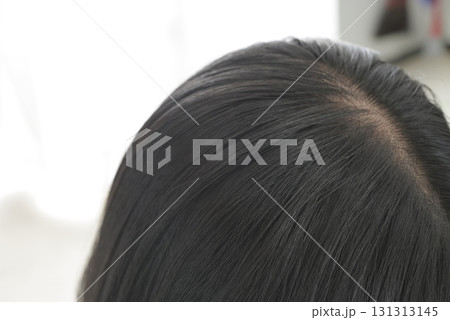女性の髪の毛の分け目 女性の髪の毛の分け目 131313145