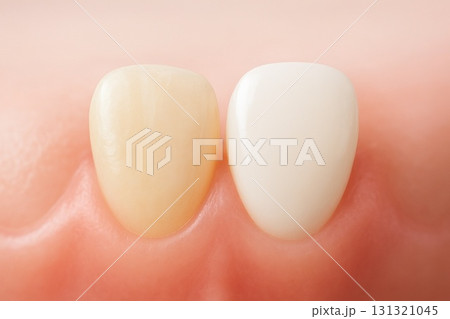 歯科治療　dental care 131321045
