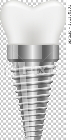 A shiny, silver dental implant featuring screw threads and a white tooth cap, standing alone. A shiny, silver dental implant featuring screw threads and a white tooth cap, standing alone. 131330301