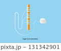Vagal nerve stimulation (VNS). Neuromodulation device for treatment of epilepsy 131342901