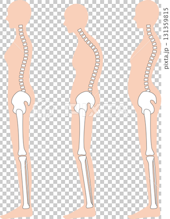 Woman with correct posture: spine and pelvis 131359815