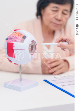 Elderly Patient consulting Doctor to Eye disease, Senior Medical Diagnosis. Anatomy Eye model for Cataract, Glaucoma, Age Related Macular Degeneration, Diabetic Retinopathy, Vitreous, health concept 131360684