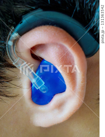 補聴器装用の耳クローズアップ 131363542