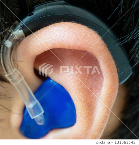 補聴器装用の耳クローズアップ 131363543