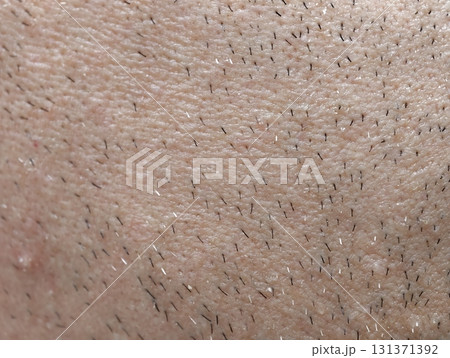 skin of the man's face with stubble and flaky skin, sparse gray hairs in the beard. 131371392