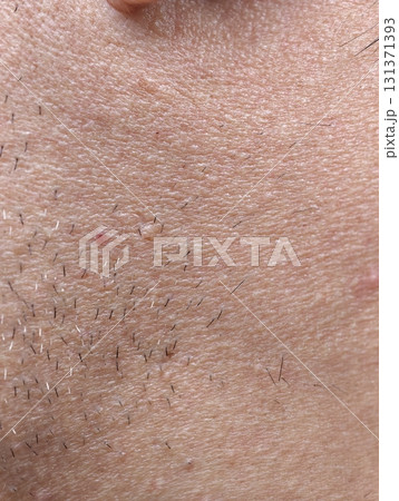 skin of the man's face with stubble and flaky skin, sparse gray hairs in the beard. skin of the man's face with stubble and flaky skin, sparse gray hairs in the beard. 131371393