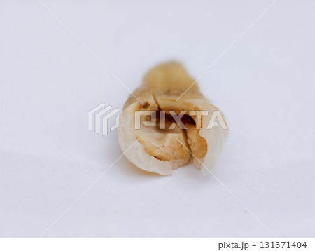 Pulled out cracked and damaged tooth, second premolar on a white background 131371404