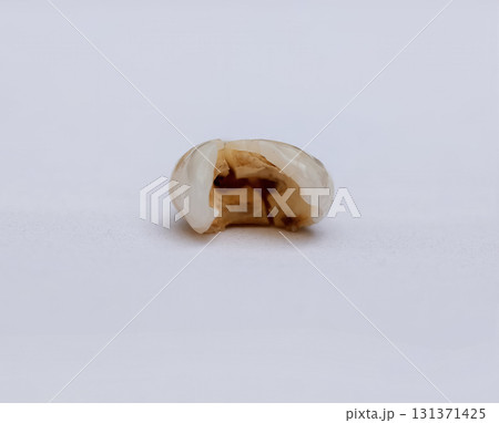 Pulled out cracked and damaged tooth, second premolar on white background 131371425