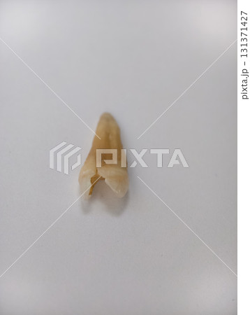 Pulled out cracked and damaged tooth, second premolar on white background Pulled out cracked and damaged tooth, second premolar on white background 131371427