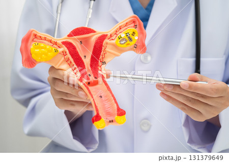 Uterus, doctor holding human anatomy model for study diagnosis and treatment in hospital. Uterus, doctor holding human anatomy model for study diagnosis and treatment in hospital. 131379649